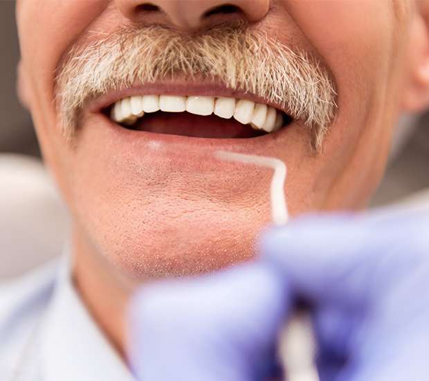 Leander Adjusting to New Dentures
