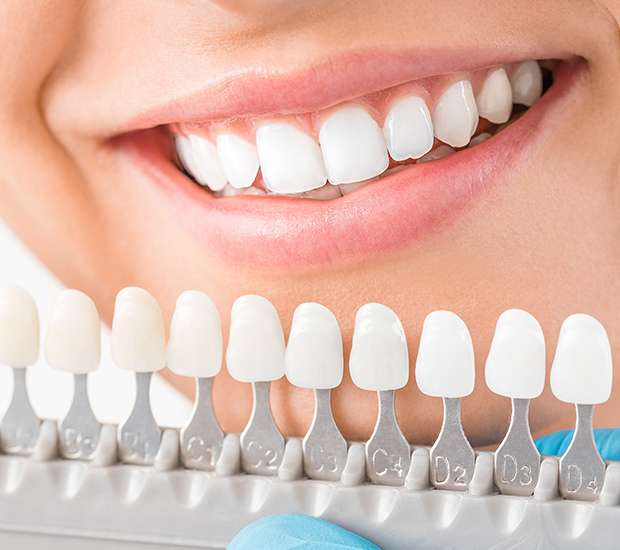 Leander Cosmetic Dentist