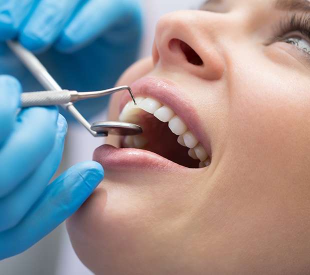 Leander Dental Bonding
