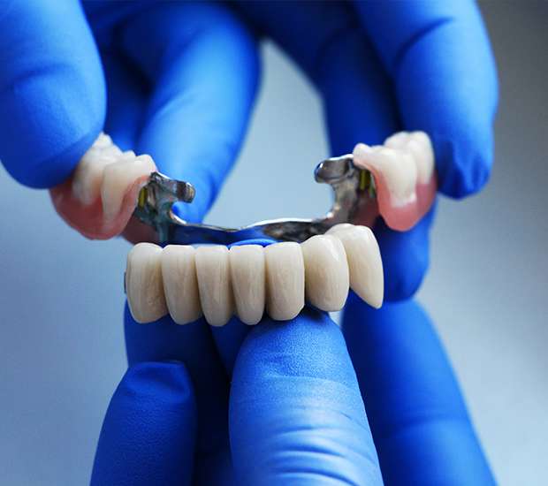Leander Dental Bridges