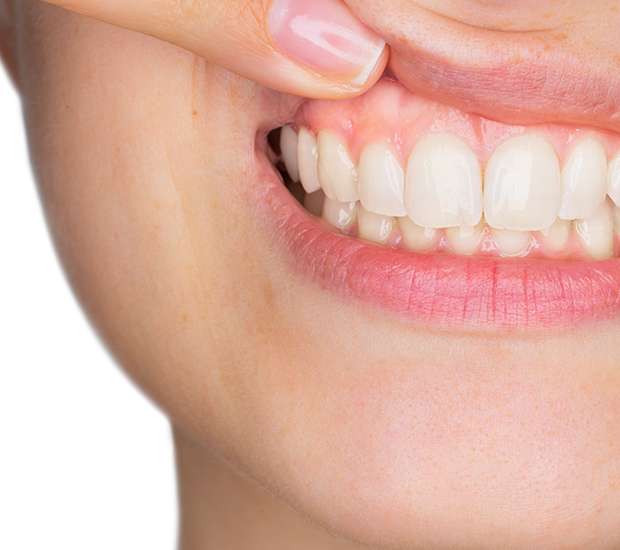 Leander Gum Disease