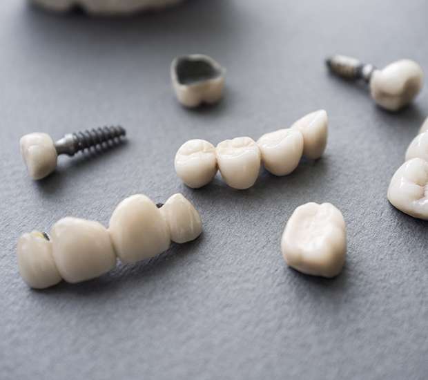 Leander The Difference Between Dental Implants and Mini Dental Implants