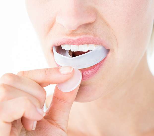 Leander Mouth Guards