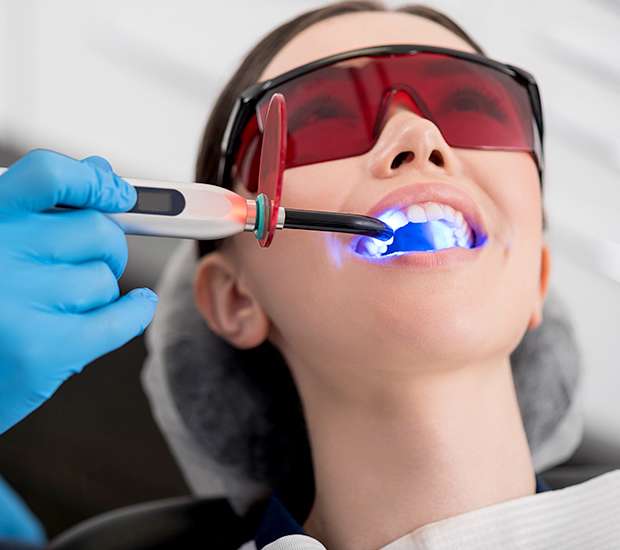 Leander Professional Teeth Whitening